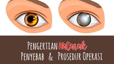 Katarak, Pengertian, Penyebab Dan Prosedur Operasi