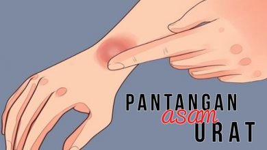 Pantangan Asam Urat Yang Sebaiknya Dihindari