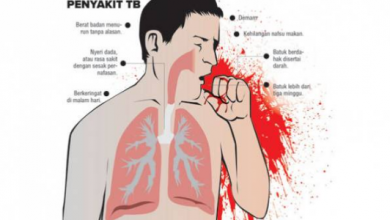 Tanda, gejala dan Penyebab Penyakit TBC